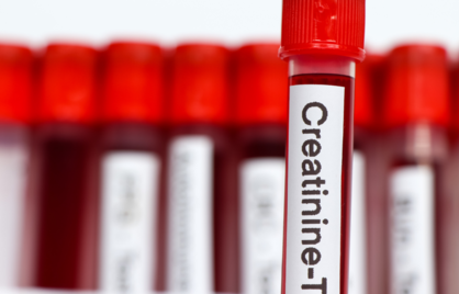 Wat zegt jouw kreatinine over je gezondheid? Ontdek het met een eenvoudige bloedtest