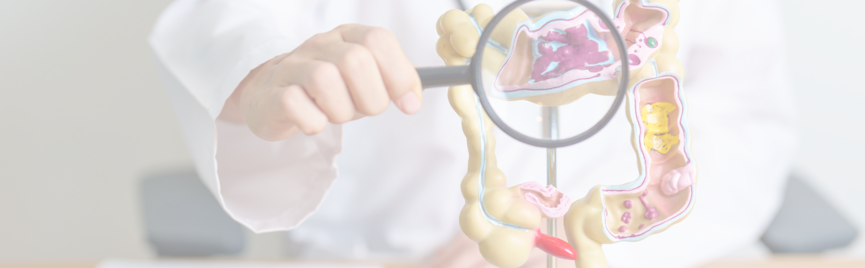 Overzicht: Prikkelbare Darm Syndroom (PDS) en Diagnostische Keuzemogelijkheden