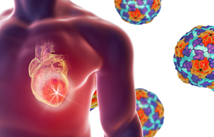  Lp(a) de vergeten risicofactor voor hart- en vaatziekten