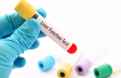 De thymoltest: waarom deze oude levertest (bijna) niet meer wordt gebruikt