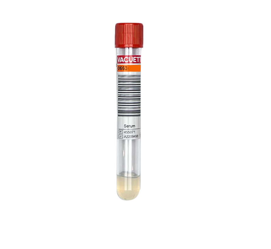 Bloedonderzoek Testosteron  LCMS/MS