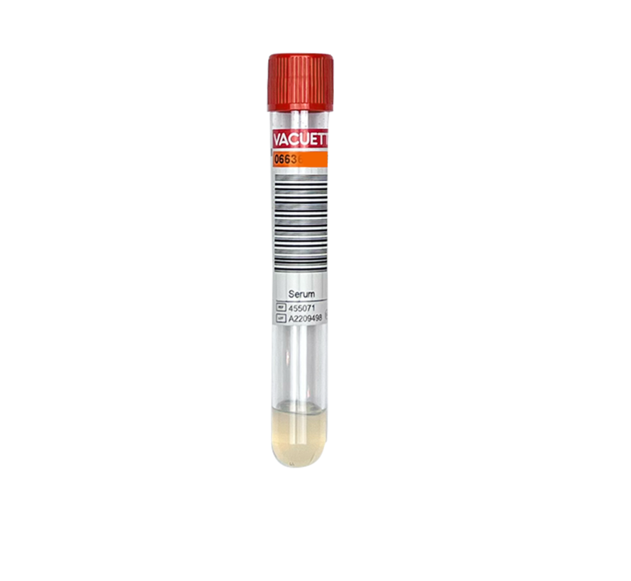 Bloedonderzoek Testosteron  LCMS/MS