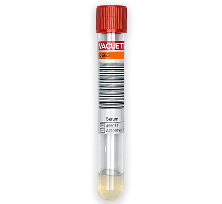 Apolipoproteine B (ApoB) - en LPA