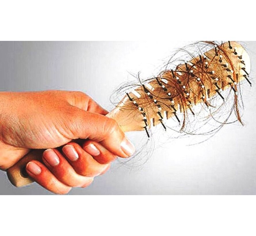 Aanvullend Pakket Haaruitvalonderzoek voor Vrouwen