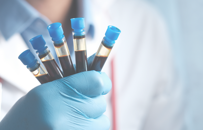 De ultieme bloedtest voor duursporters: zo verbeter je prestaties en herstel