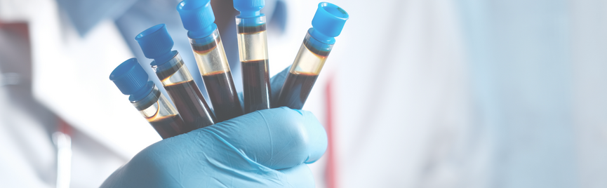 De ultieme bloedtest voor duursporters: zo verbeter je prestaties en herstel