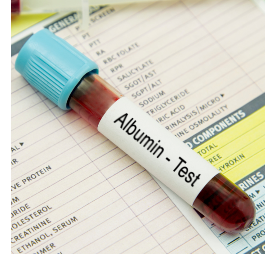 Albumine