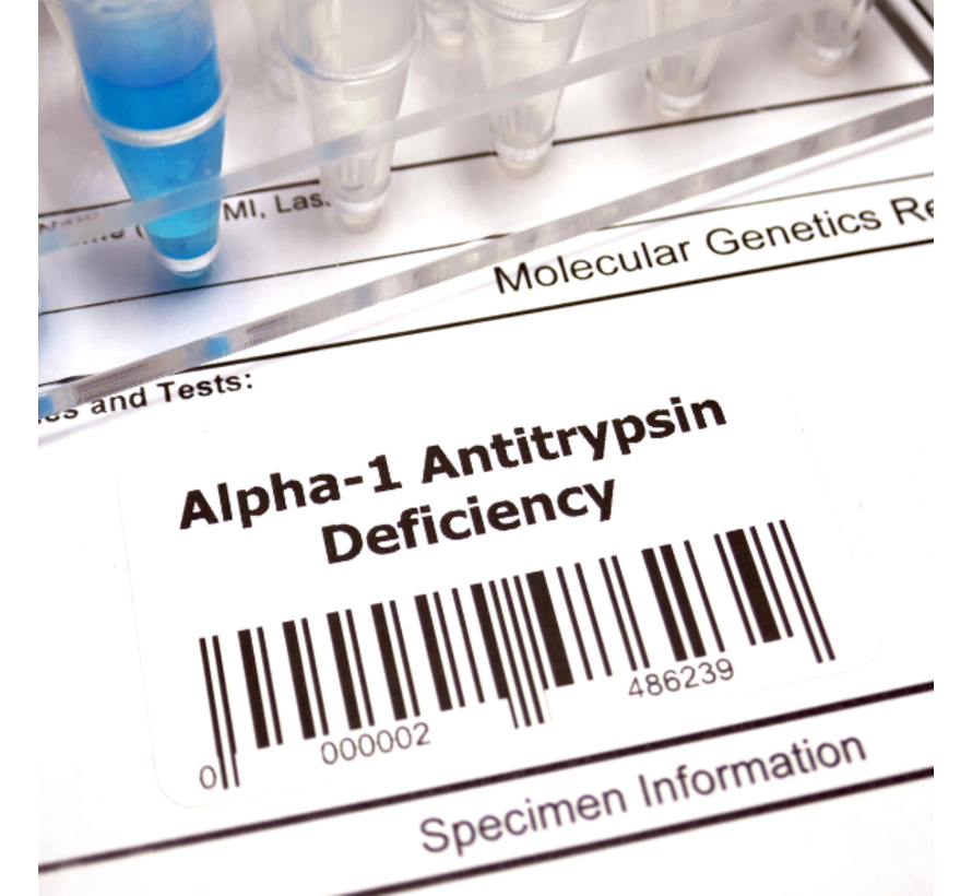 alfa-1 Antitrypsine long en lever