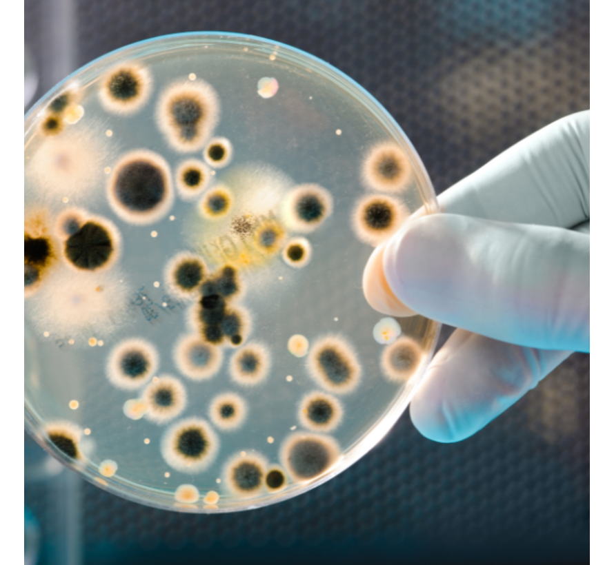 Algemene Kweek Bacteriën in ontlasting