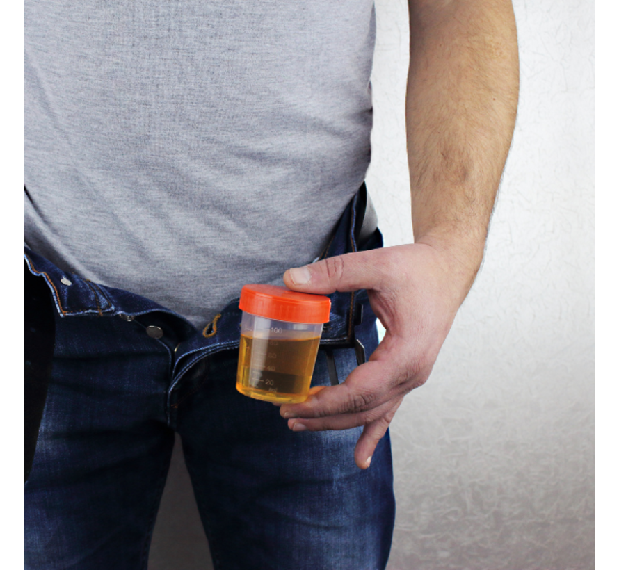 Amfetamines in urine screening (o.a. speed)