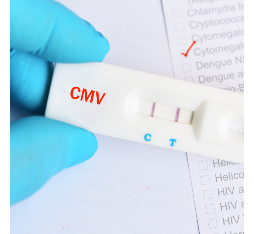 CMV IgG IgM