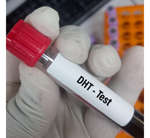 Dihydrotestosteron  (DHT)