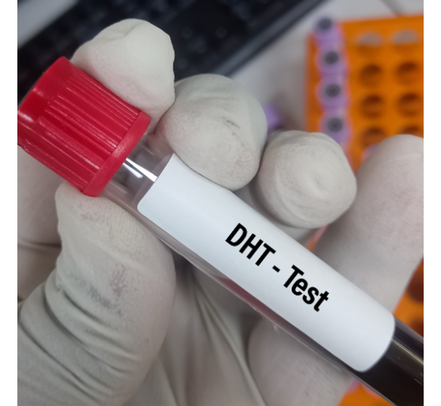 Dihydrotestosteron  (DHT)