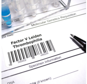 Factor V Leiden