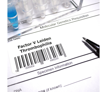 Factor V Leiden