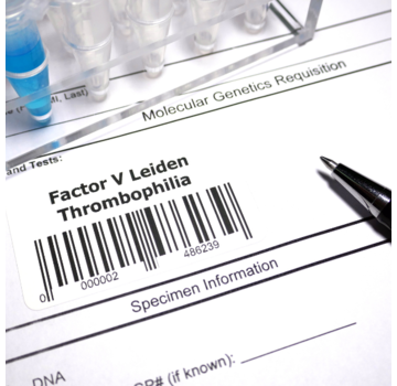 Factor V Leiden