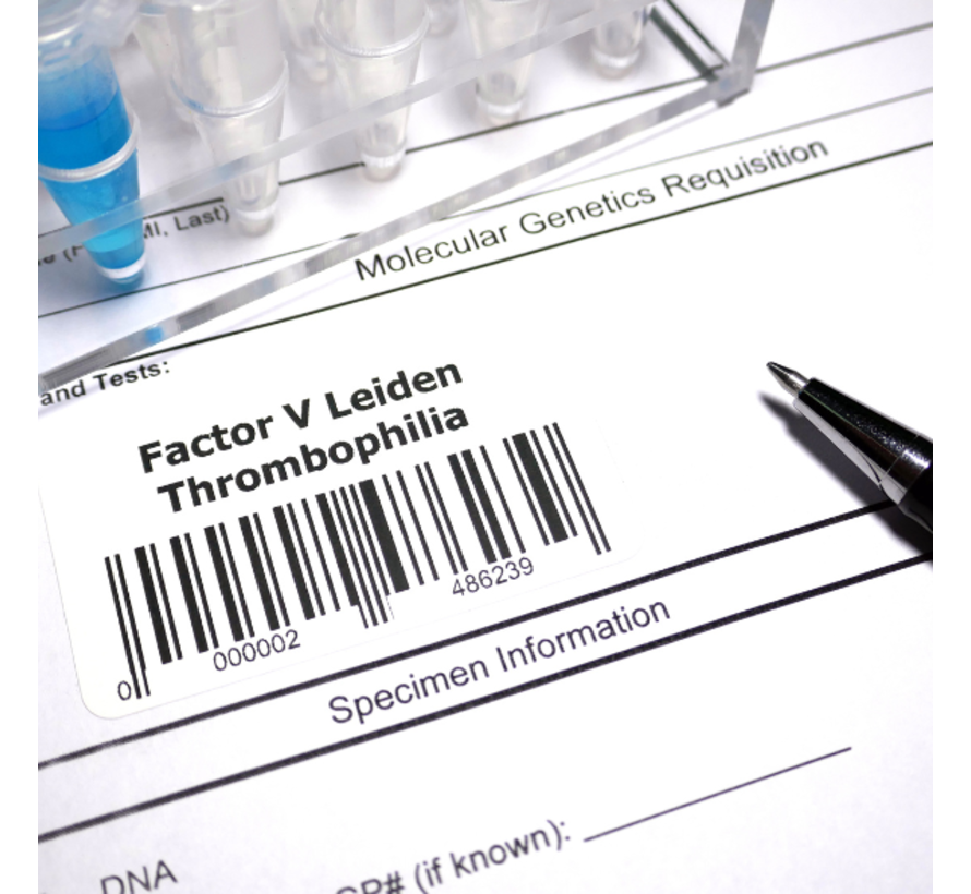 Factor V Leiden PCR bloedstolling