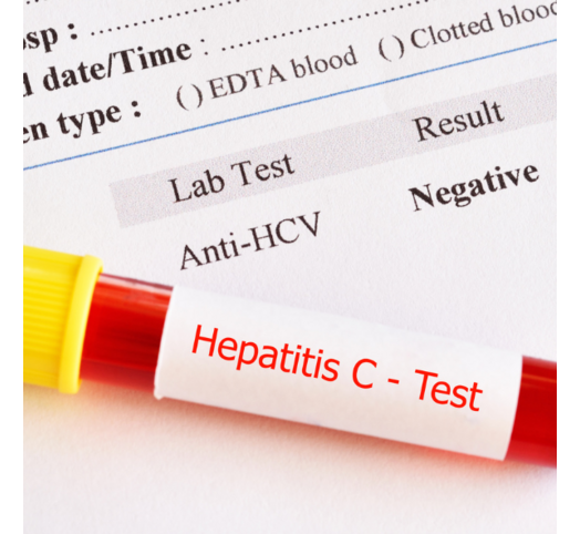 Hepatitis C infectie?