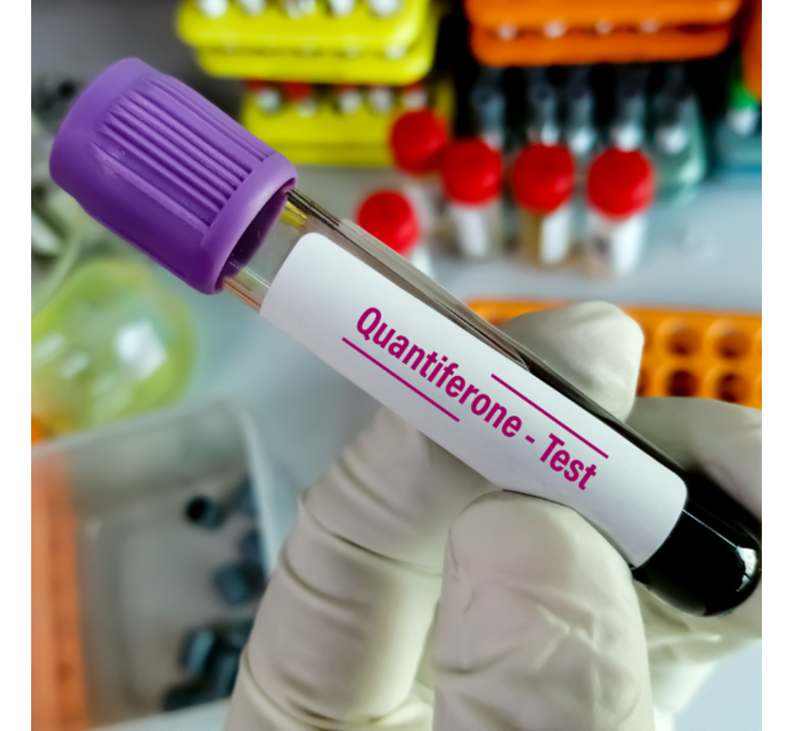 Quantiferontest TBC IGRA tuberculose