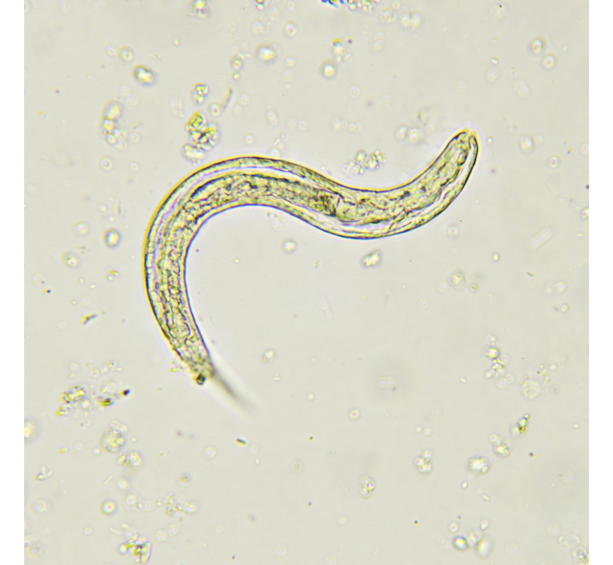 Strongyloides Stercoralis Infectie