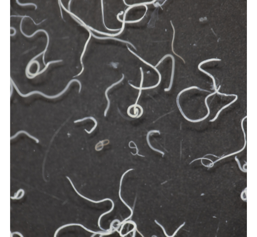 Toxocara Hondenspoelworm IgG toxocariasis