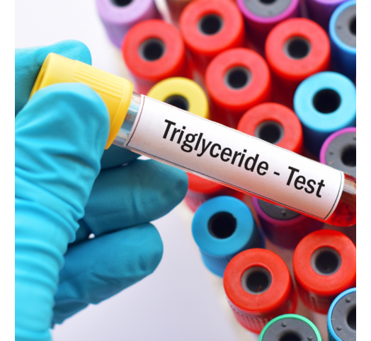 Triglyceriden