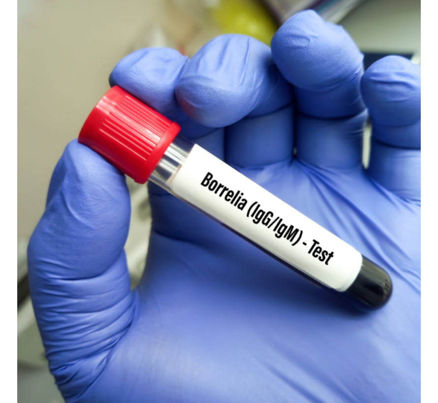 ziekte van Lyme Borrelia IgM Blot bevestigingstest