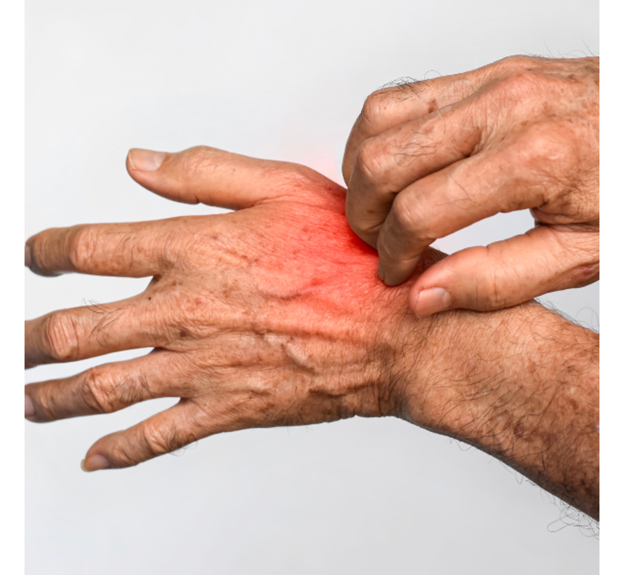 Kattenkrabziekte Bartonella henselae  PCR