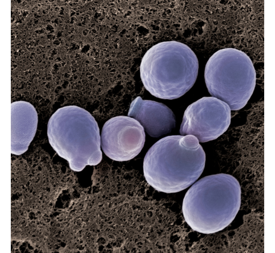 Candida Albicans IgA, IgG  schimmelinfectie