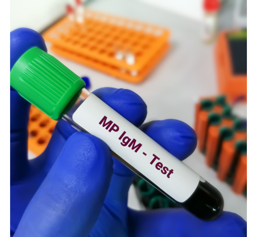 Cardiolipine  (IGM) antistoffen SLE