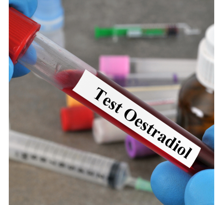 Oestradiol ook bekend als  Oestrogeen (voor mannen)
