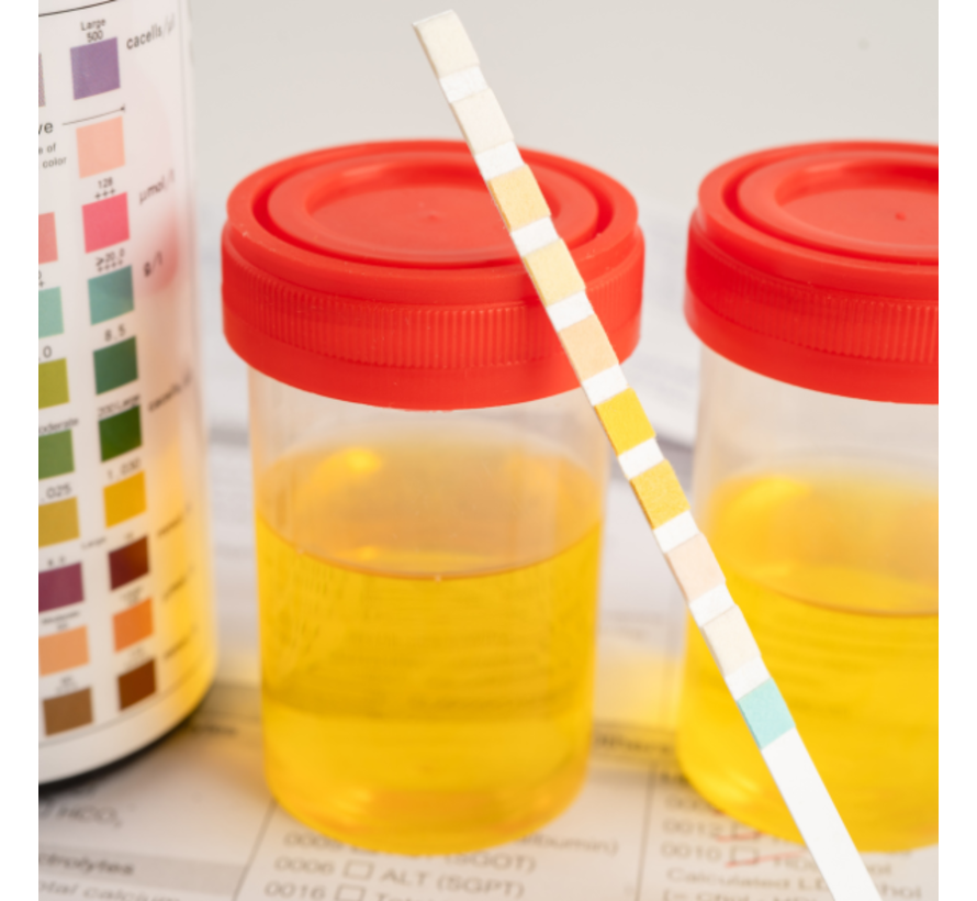 Glyfosaat: microbioom schade door bestrijdingsmiddelen