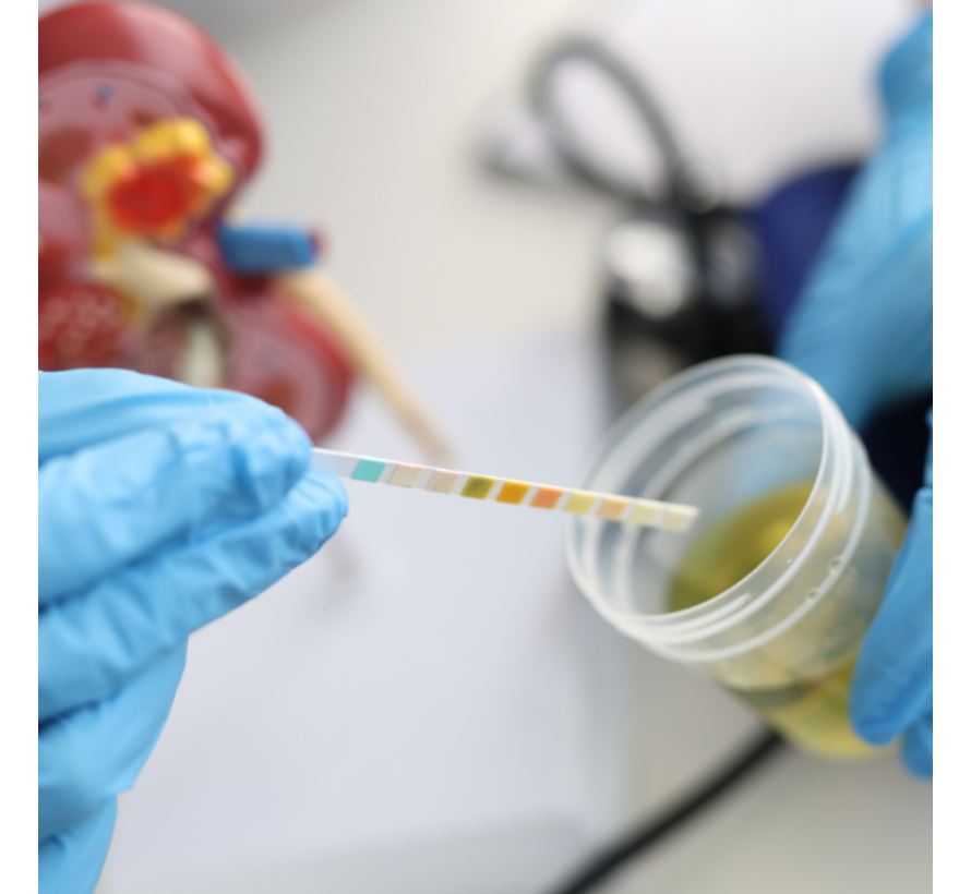 CBR Drugsscreening urine per stuk staffel