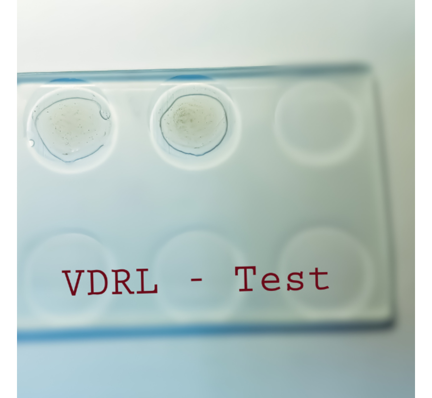 VDRL - Test (Cardiolipine Microflocculatietest)