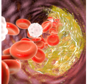 Lipodens lipoproteïneprofiel