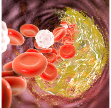 Lipodens lipoproteïneprofiel