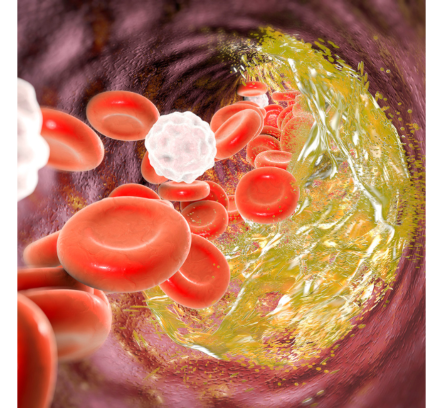 Lipodens lipoproteïneprofiel