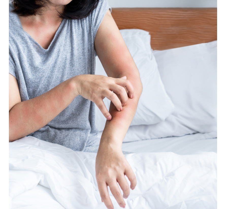 Allergietest wespengif en bijengif