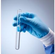 NIEUW  Drugsscreening bloedonderzoek