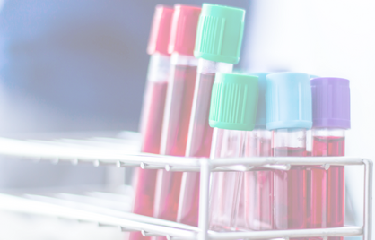 Gezondheidschecks: let op de context van je bloedwaarden