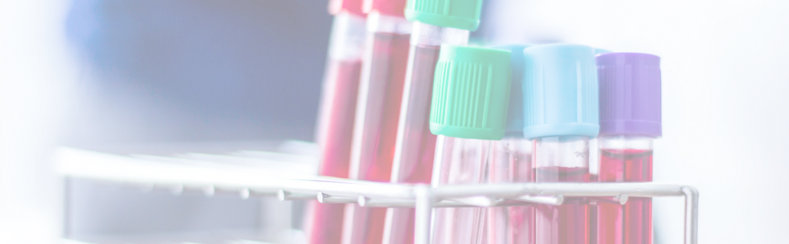 Gezondheidschecks: let op de context van je bloedwaarden