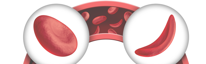 Alles over bloedarmoede: symptomen, oorzaken en hoe je het laat testen