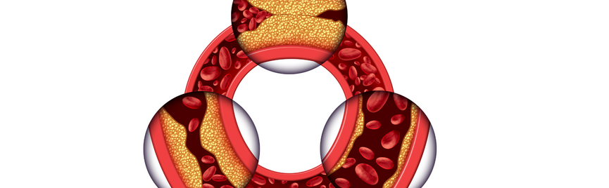 5 verrassende factoren die je cholesterol beïnvloeden (en waarom het niet alleen om LDL draait)