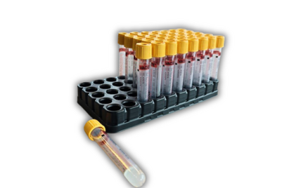 Bloedwaardentest zet stap naar verduurzaming