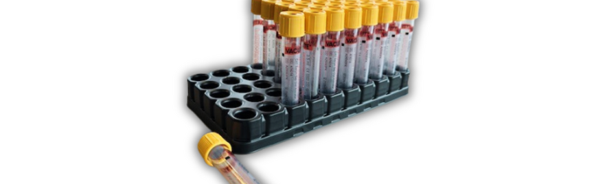 Bloedwaardentest zet stap naar verduurzaming