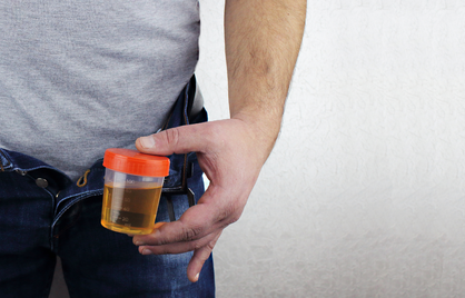 Urinalysis Explained: What Your Urine Says About Your Health