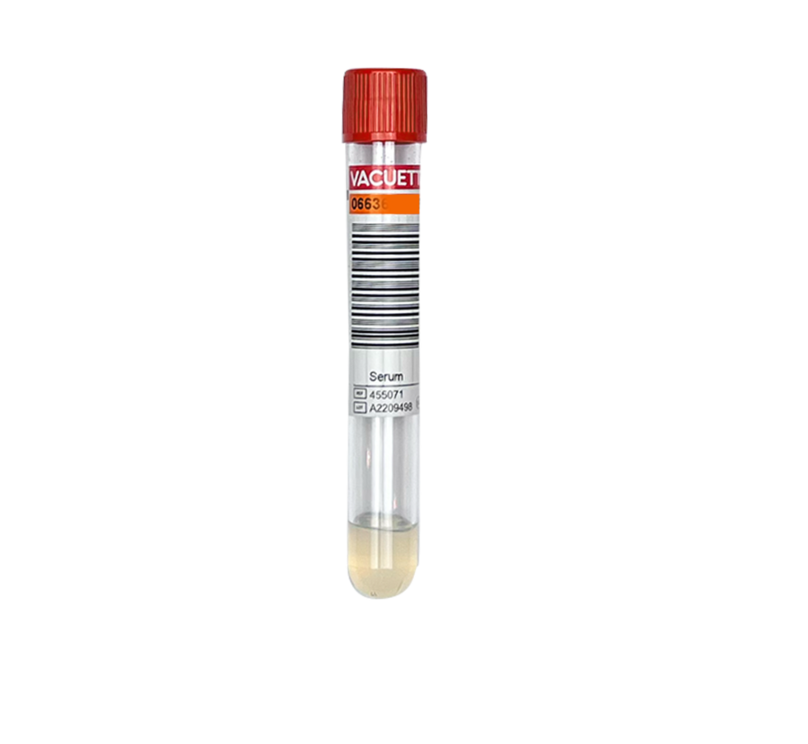 Bloedonderzoek Testosteron (vrij) + SHBG+ DHEA-s - Vingerprik - Copy