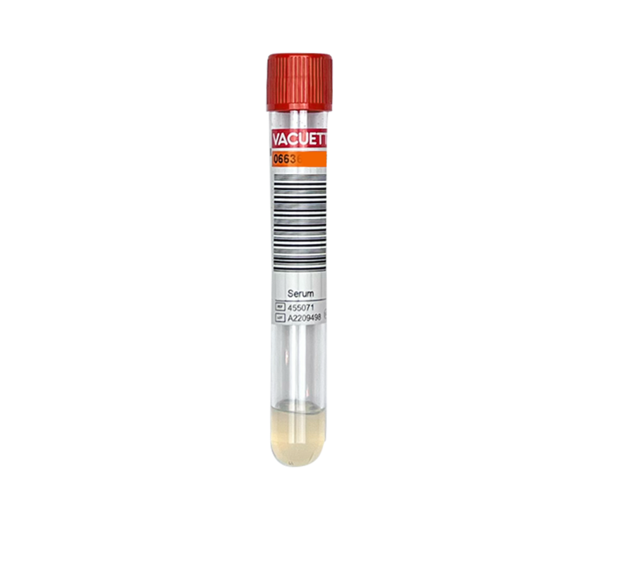 Bloedonderzoek Testosteron (vrij) + SHBG+ DHEA-s - Vingerprik - Copy