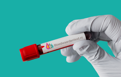 Bloedonderzoek zonder verwijzing van een huisarts