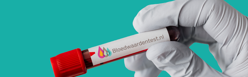 Bloedonderzoek zonder verwijzing van een huisarts